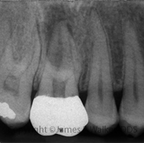 Molar